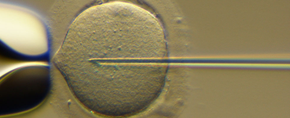 做赠卵试管婴儿可以一次生双胞胎吗？