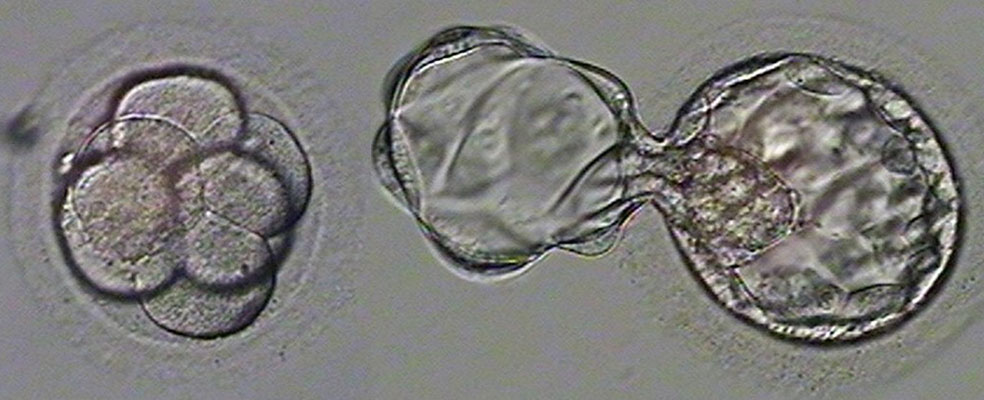 Two-Stage Embryo Transfer Technique