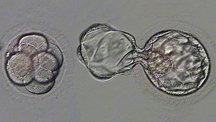 Two-Stage Embryo Transfer Technique