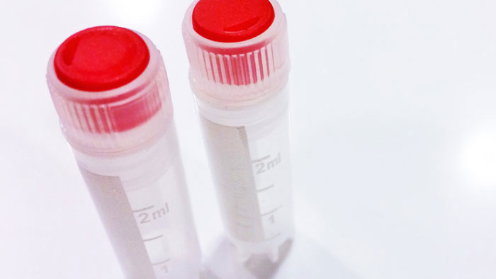 Stimulation of Endometrium Embryo Transfer (SEET)