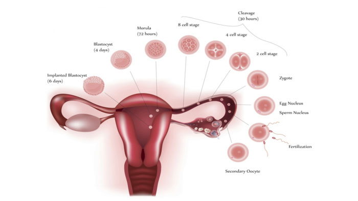 What is Infertility